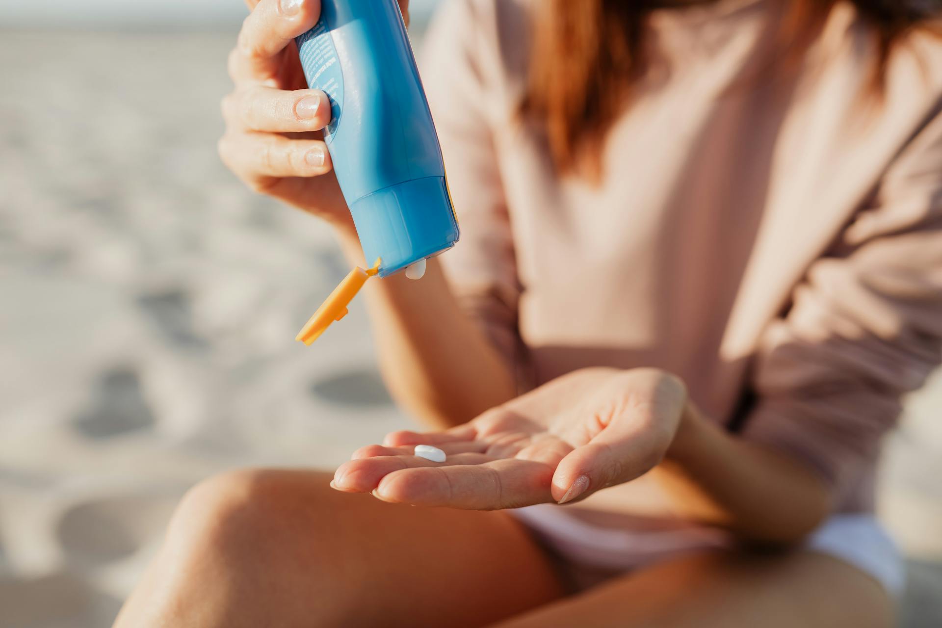 using some cream for sunburns